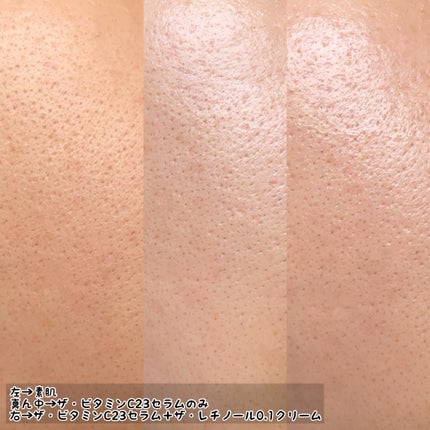 RXザ・ビタミンC23セラム/COSRX/美容液を使ったクチコミ(7枚目)