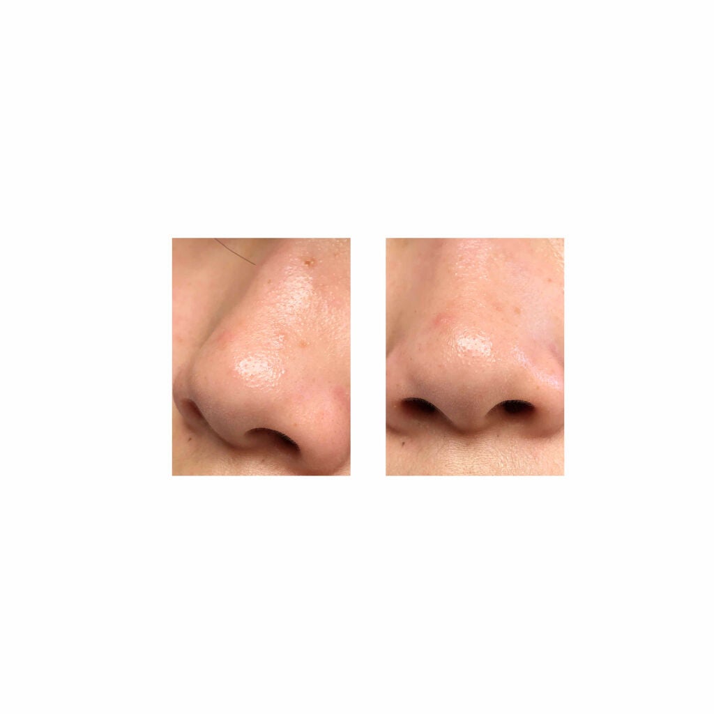 monoeðž on LIPS ã~坿ããªããã10æ¥ç®~------------------..ãïŒ2æç®ïŒ