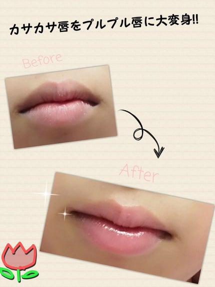 ウォーターリップ はちみつレモン/メンソレータム/リップクリームを使ったクチコミ(1枚目)