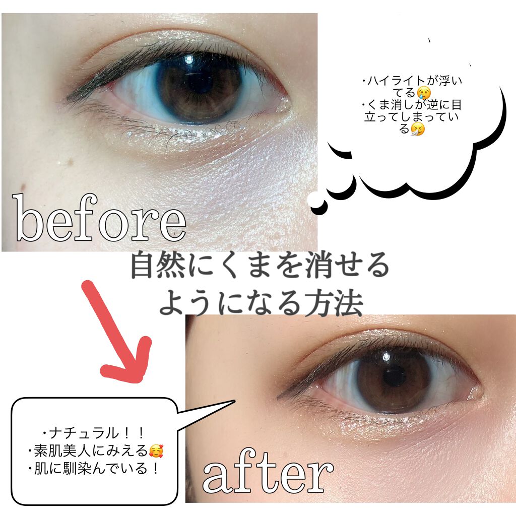 カラーミキシングコンシーラー/キャンメイク/パレットコンシーラーを使ったクチコミ（1枚目）