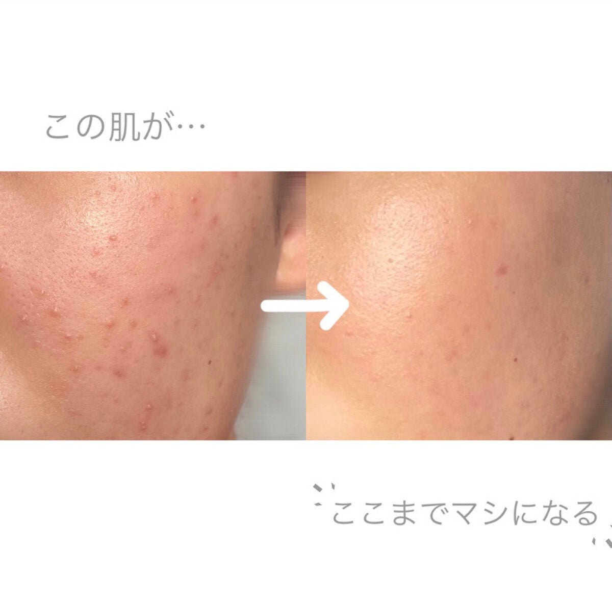 ミルキージェル オイルコントロール/アベンヌ/オールインワン化粧品を使ったクチコミ(1枚目)