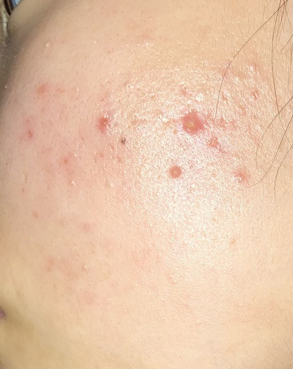 マイルド＆モイスチャーアロエジェル/ネイチャーリパブリック/ボディローションを使ったクチコミ（3枚目）