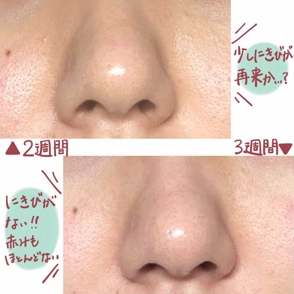 マデカクリーム/センテリアン24/フェイスクリームを使ったクチコミ(4枚目)