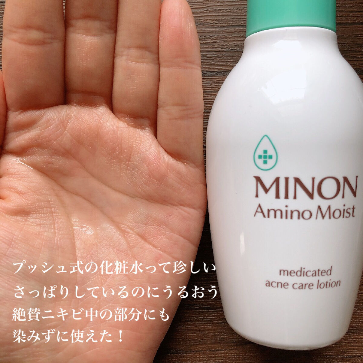 ミノン アミノモイスト 薬用アクネケア ローション/ミノン/化粧水を使ったクチコミ（2枚目）