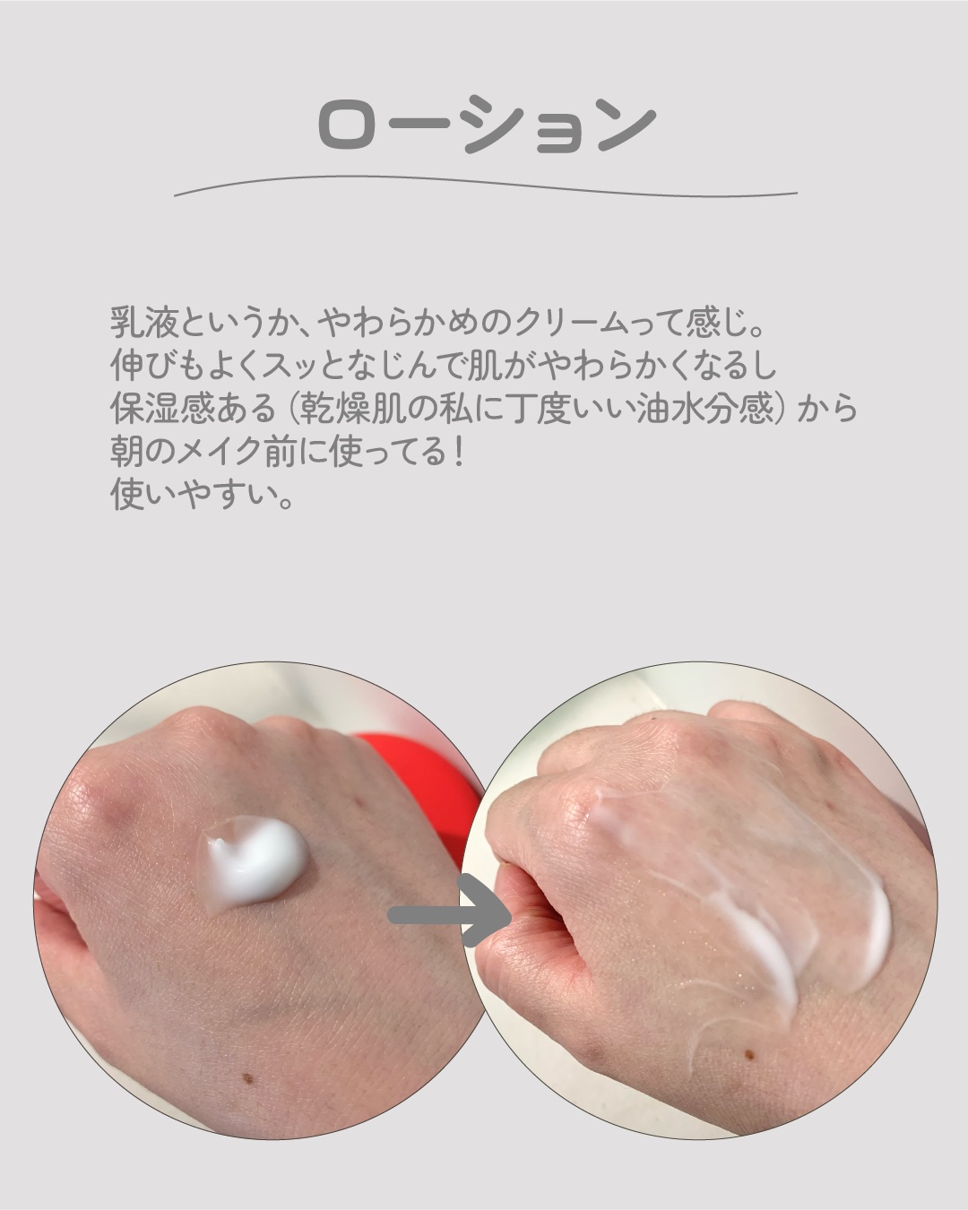 アトパーム MLE ローション 120ml/ATOPALM/乳液を使ったクチコミ（3枚目）