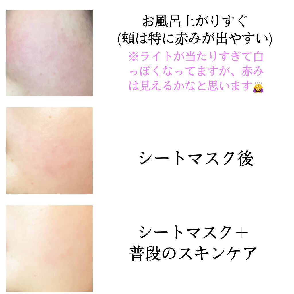  ダーマエクトシカデイリーマスク/Neulii/シートマスク・パックを使ったクチコミ（2枚目）