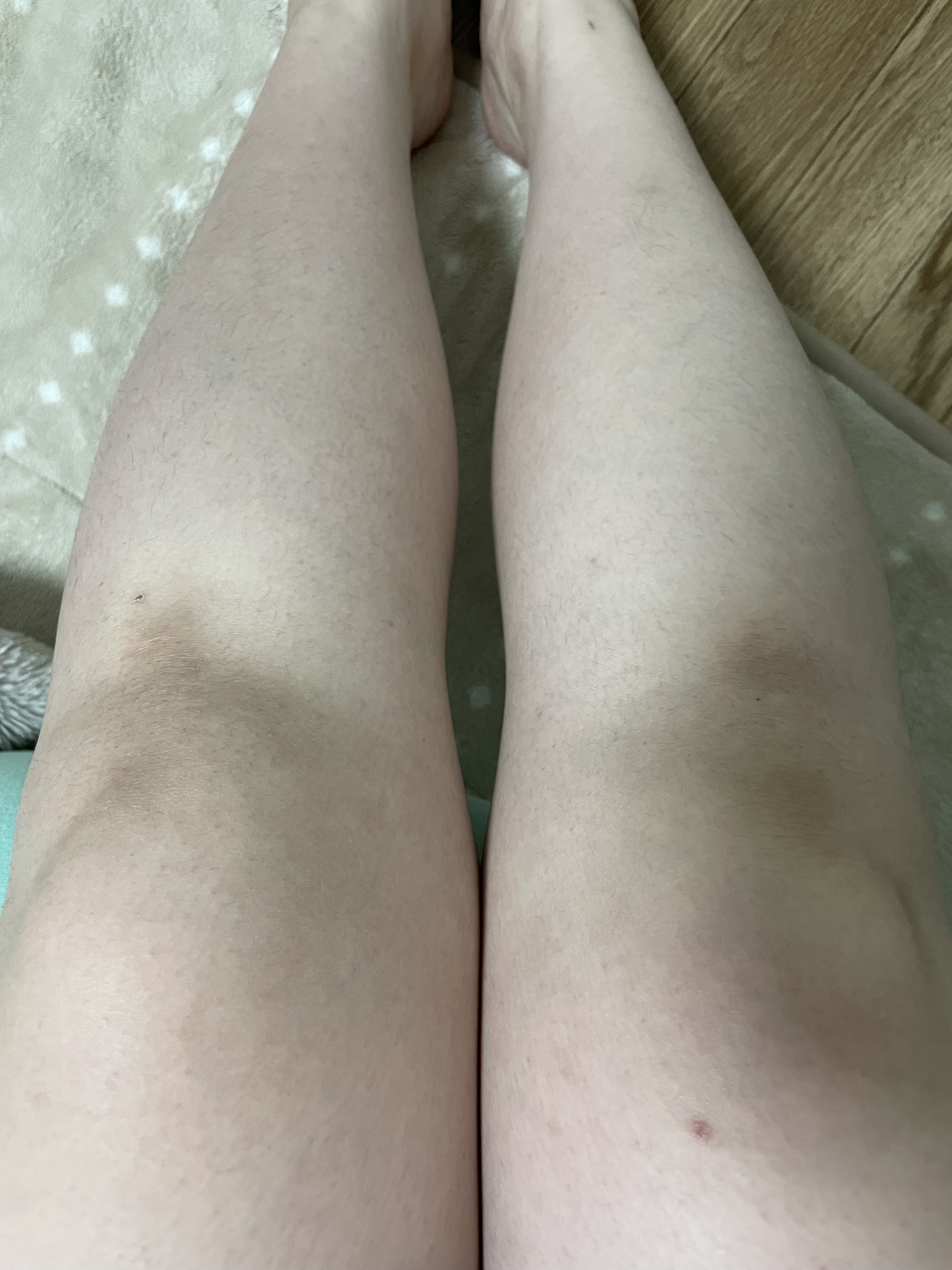 ボディミルク/IROKE/ボディミルクを使ったクチコミ（1枚目）