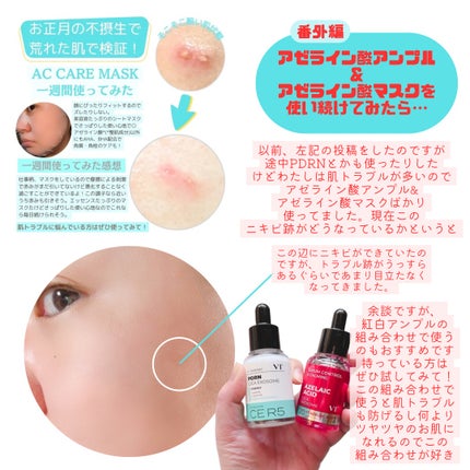 AZケア マスク/VT/シートマスク・パックを使ったクチコミ(4枚目)