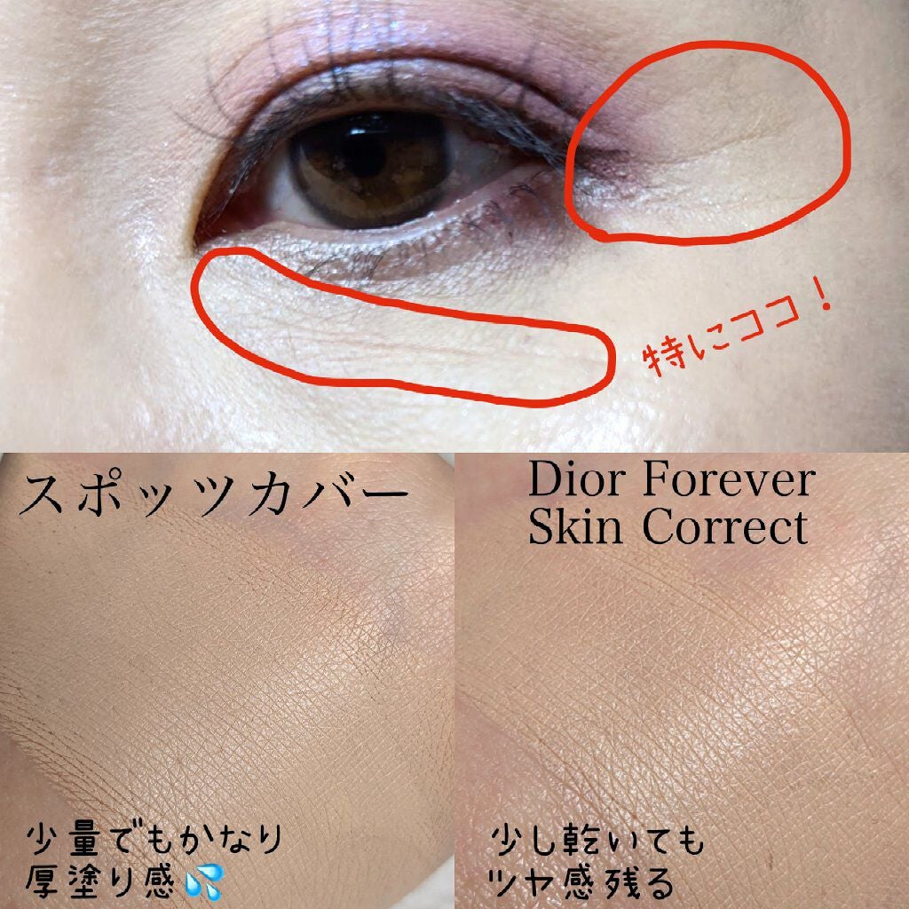 スポッツカバー ファウンデイション/SHISEIDO/クリームコンシーラーを使ったクチコミ(2枚目)