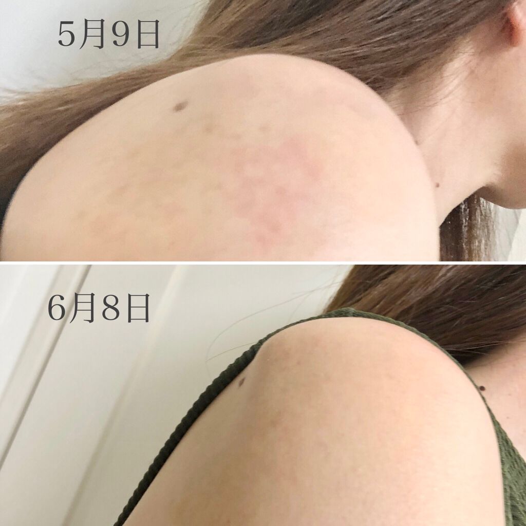 シルククリーム/エルツティン/美容液を使ったクチコミ（3枚目）