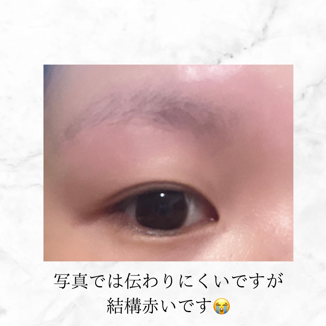 脱色クリーム 敏感肌用/エピラット/ムダ毛ケアを使ったクチコミ（2枚目）