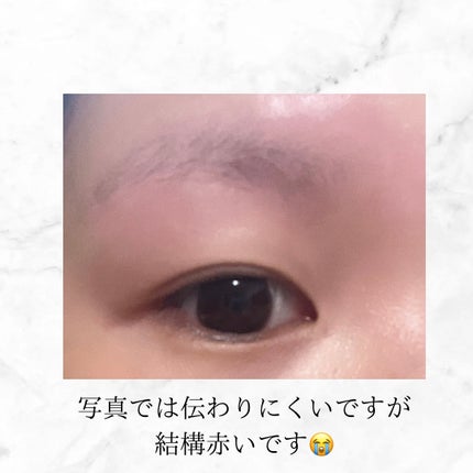 脱色クリーム 敏感肌用/エピラット/ムダ毛ケアを使ったクチコミ(2枚目)