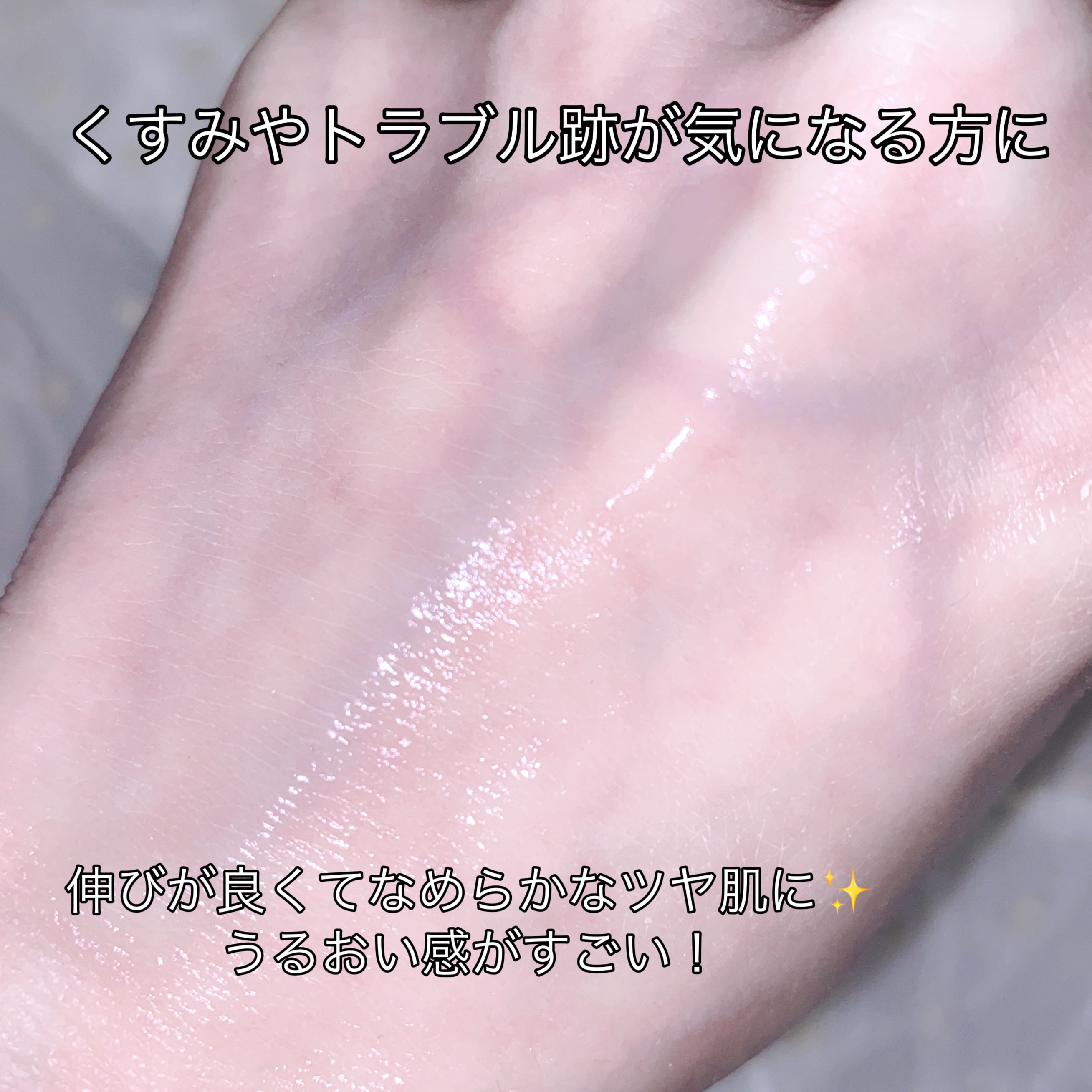 ディメラナイザートーニングアンプル/PHYSIOGEL/美容液を使ったクチコミ（3枚目）