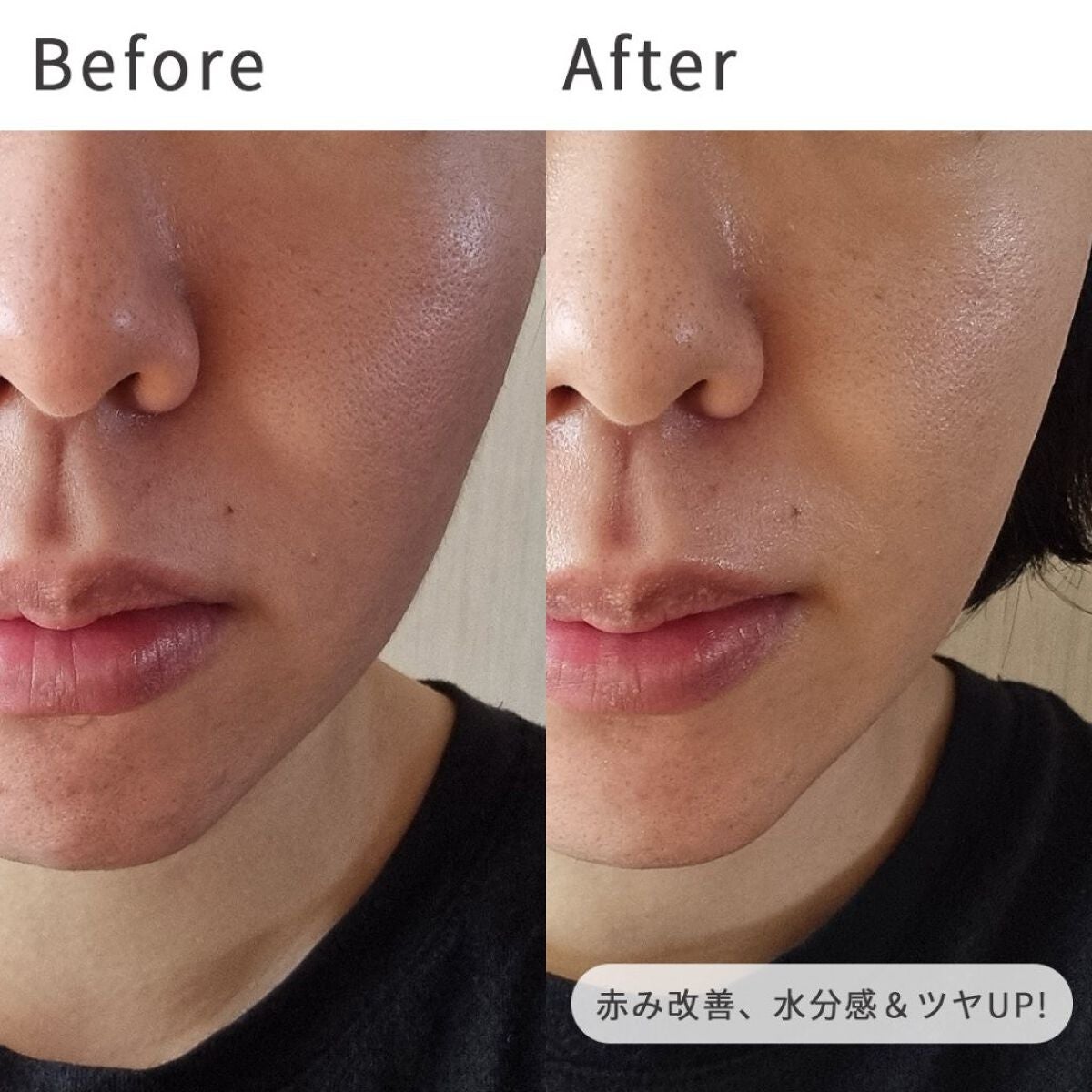 バイオ コンディショニング エッセンス/IOPE/ブースター・導入液を使ったクチコミ(4枚目)