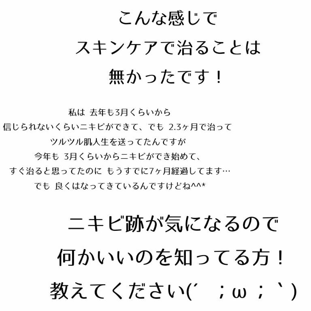 ノブ A アクネソープ/NOV/洗顔石鹸を使ったクチコミ(4枚目)
