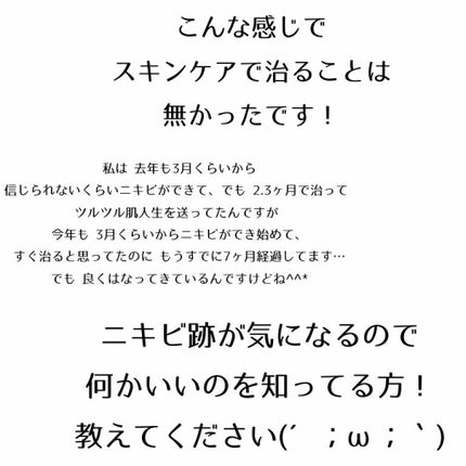 ノブ A アクネソープ/NOV/洗顔石鹸を使ったクチコミ(4枚目)