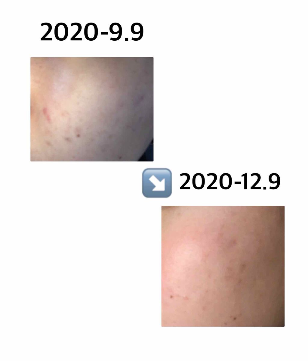 あぃら on LIPS 「【こんにちは🙋♀️💖あぃらです☼☁*°⠀】・今回は私がここま..」(3枚目)