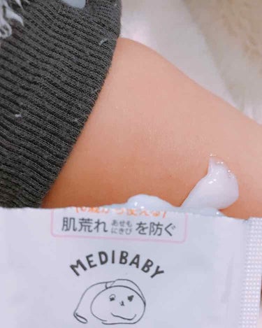 薬用泡フェイス&ボディソープ/MEDIBABY/泡洗顔を使ったクチコミ（3枚目）