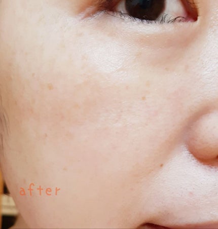 インナーモイスチュアエッセンス No.11/RAIZ repair/美容液を使ったクチコミ(7枚目)