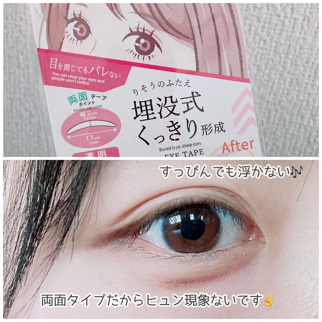 りそうのふたえ 埋没式くっきり形成/DAISO/二重まぶた用アイテムを使ったクチコミ(5枚目)