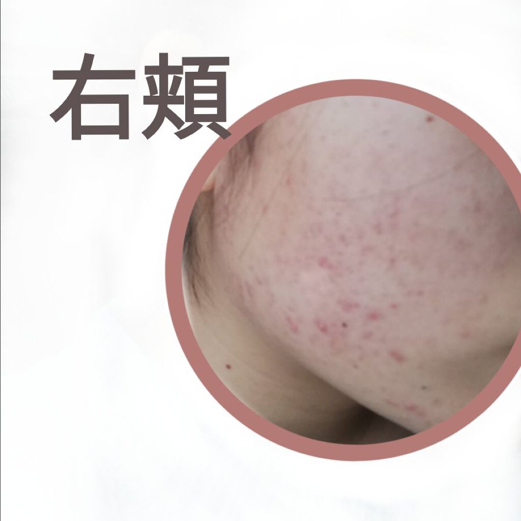 DHC マルチビタミン/DHC/美容サプリメントを使ったクチコミ(2枚目)