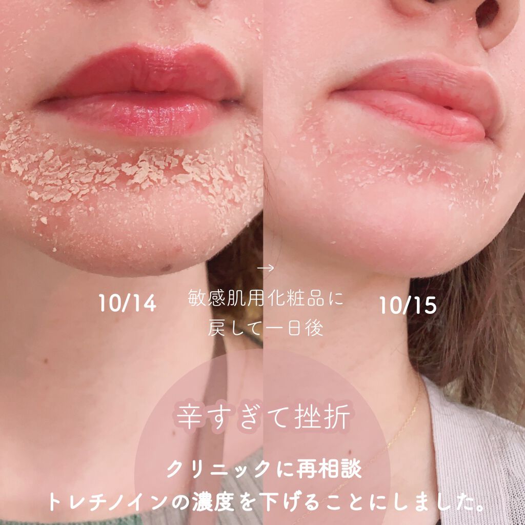 ZO Skin Healthのスキンケア・基礎化粧品 デイリーPD＆ミラミックス