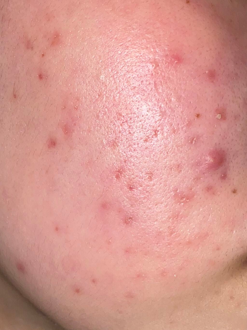 민트짱 on LIPS 「こんばんは...🌙久しぶりにちゃんと書く気になったので書きます..」(2枚目)