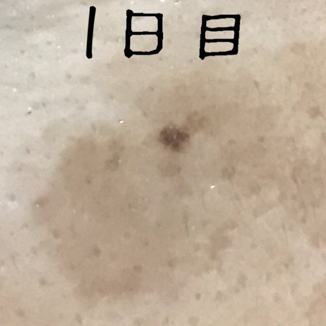 QuSomeホワイト2.0/b.glen/美容液を使ったクチコミ(2枚目)