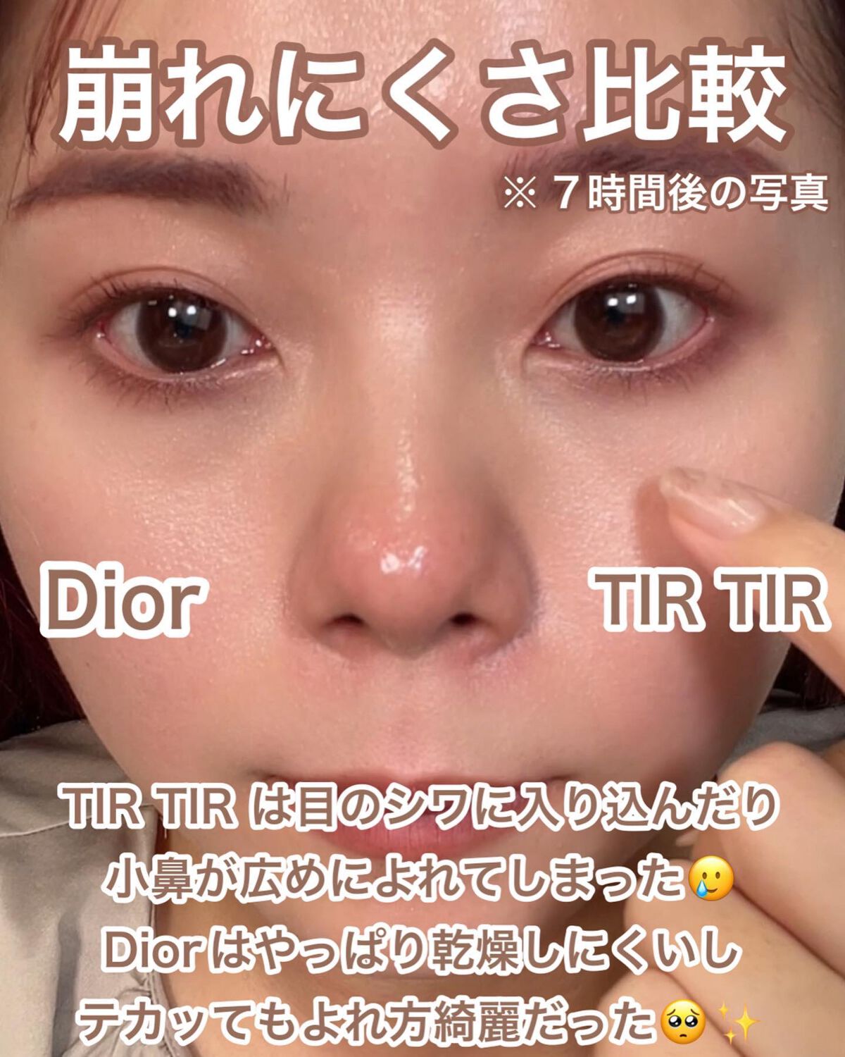 【旧】ディオールスキン フォーエヴァー スキン コレクト コンシーラー/Dior/リキッドコンシーラーを使ったクチコミ(7枚目)