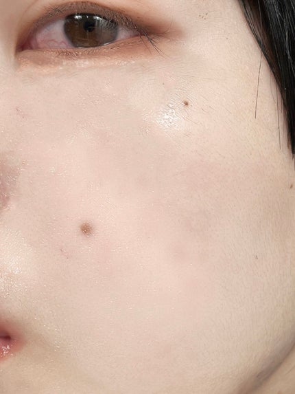 THE N.M.F アクティブ AP/MEDIHEAL/美容液を使ったクチコミ(1枚目)