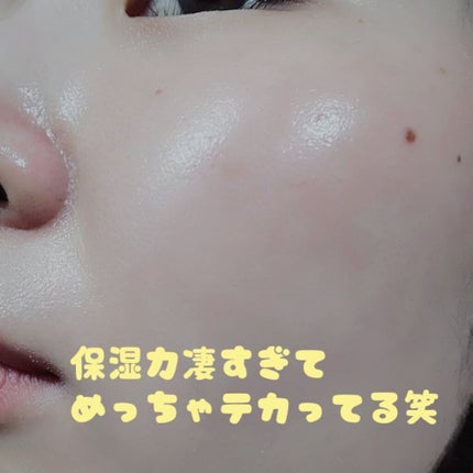 one オールインワンクリーム ST/ユーグレナ/オールインワン化粧品を使ったクチコミ(4枚目)