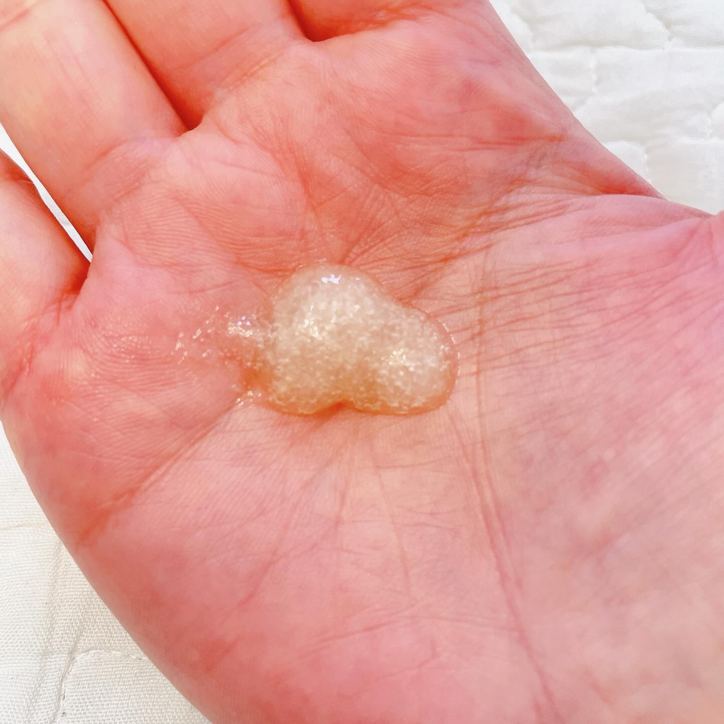 ベタールートクーリングスケーラー/Daleaf/頭皮クレンジングを使ったクチコミ（2枚目）