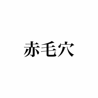 久しぶりの投稿になってしまいましたが、
ここ最近、自分の頬の赤さが本当に気になって
美容皮膚科に行こうか迷っているのですが
よく自分の顔を見た時、私の毛穴が赤い！！
って思ったんです。
毛穴が赤いのが改