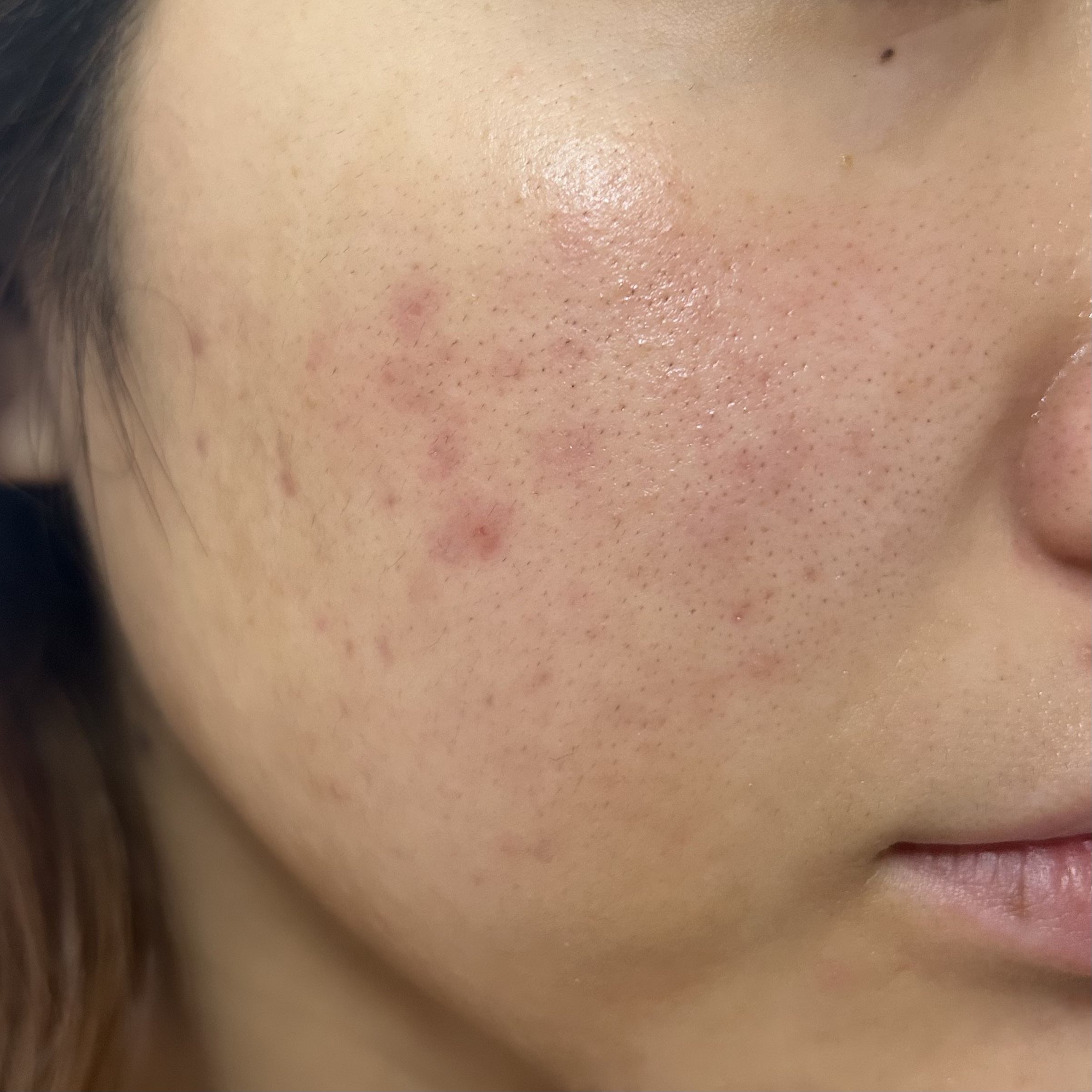 グリーンダーマCICA デイリーシートマスク 30枚(350mL)/ネイチャーリパブリック/シートマスク・パックを使ったクチコミ（1枚目）