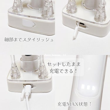 電動歯ブラシ/ION-Sei/電動歯ブラシを使ったクチコミ（9枚目）