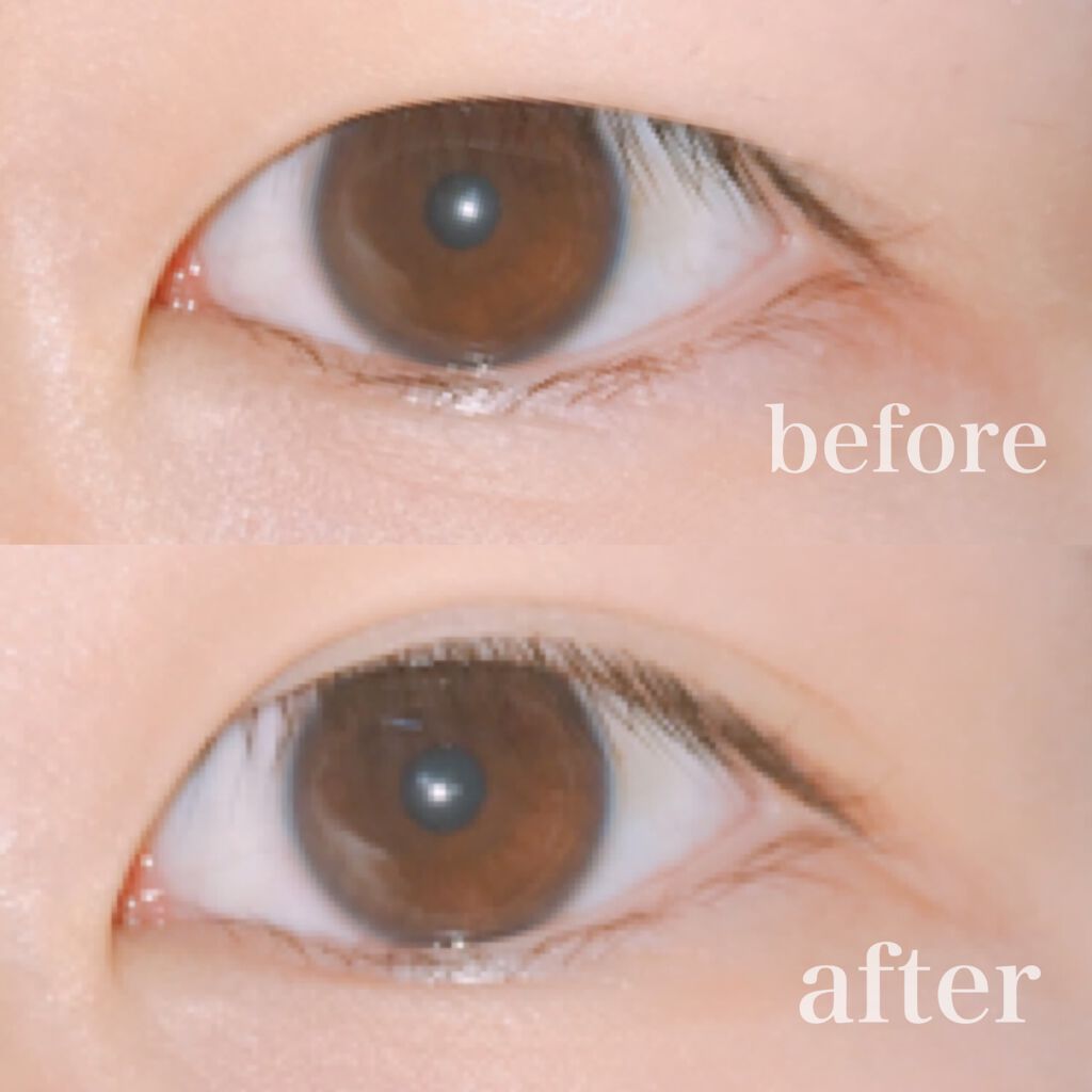 のびるアイテープ/セリア/二重まぶた用アイテムを使ったクチコミ(2枚目)