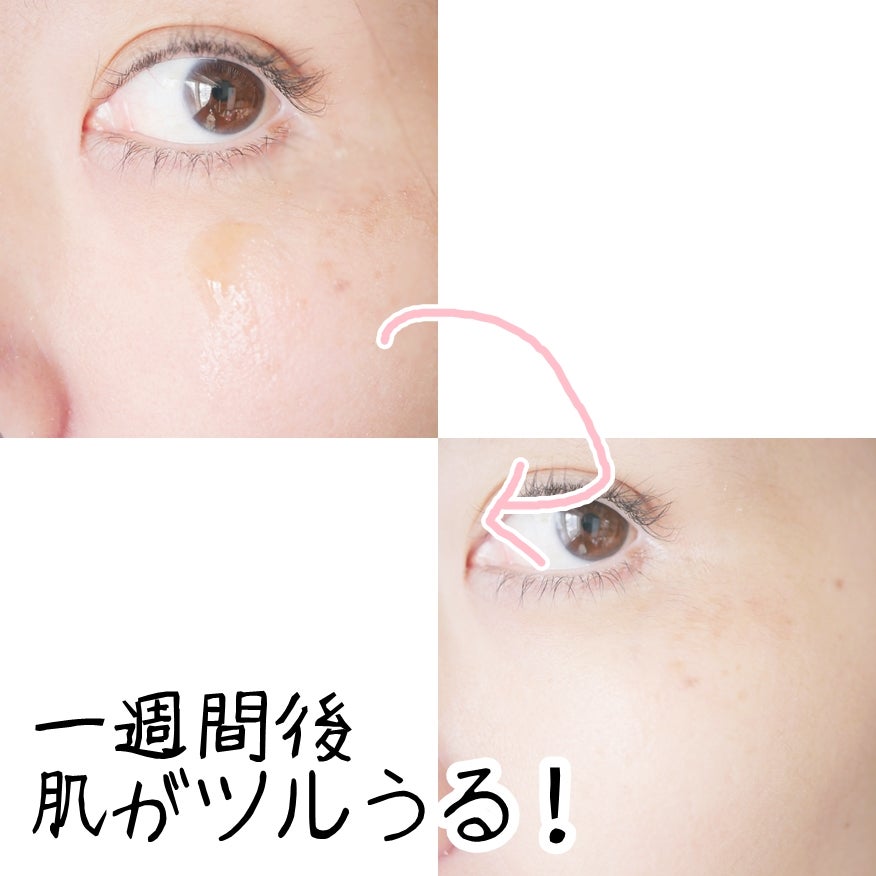 ブラックシュガーピーリングセラム/MAKE9/美容液を使ったクチコミ(7枚目)