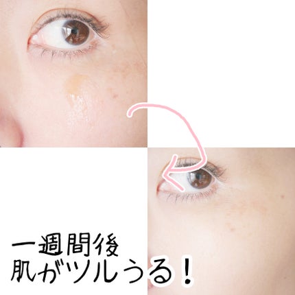 ブラックシュガーピーリングセラム/MAKE9/美容液を使ったクチコミ(7枚目)