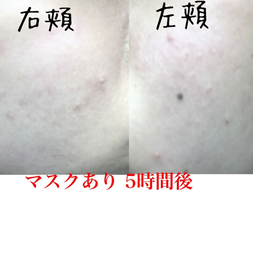 ノーセバム ミネラルパウダー/innisfree/ルースパウダーを使ったクチコミ(5枚目)