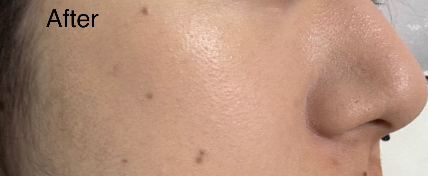 パーフェクティングフィッティング フルカバレッジクッション/LILIBETH/クッションファンデーションを使ったクチコミ(5枚目)