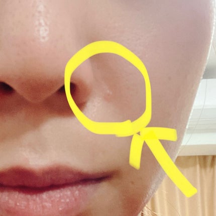 クリアパッチ/Angelab/にきびパッチを使ったクチコミ(4枚目)