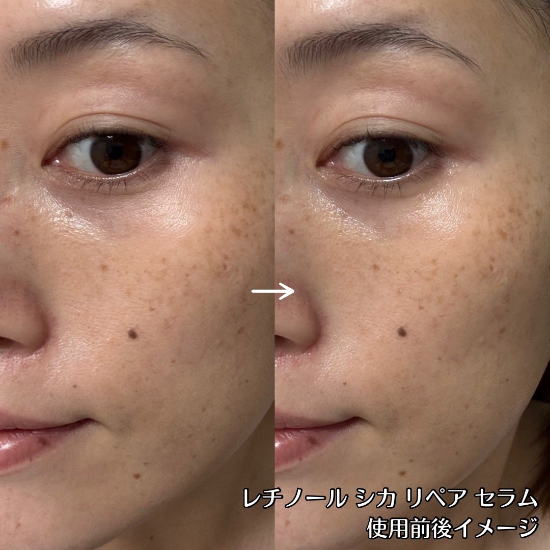 レチノール シカ リペア セラム/innisfree/美容液を使ったクチコミ(9枚目)