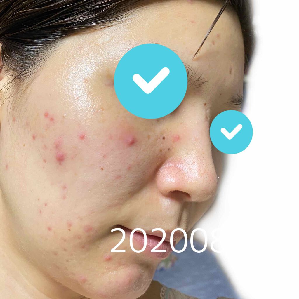 EclatCharme(エクラシャルム)/FABIUS/オールインワン化粧品を使ったクチコミ(3枚目)