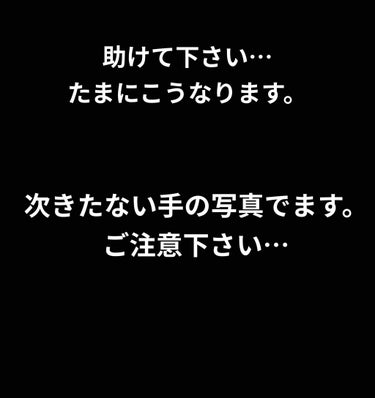 白色ワセリン(医薬品)/健栄製薬/その他を使ったクチコミ（1枚目）