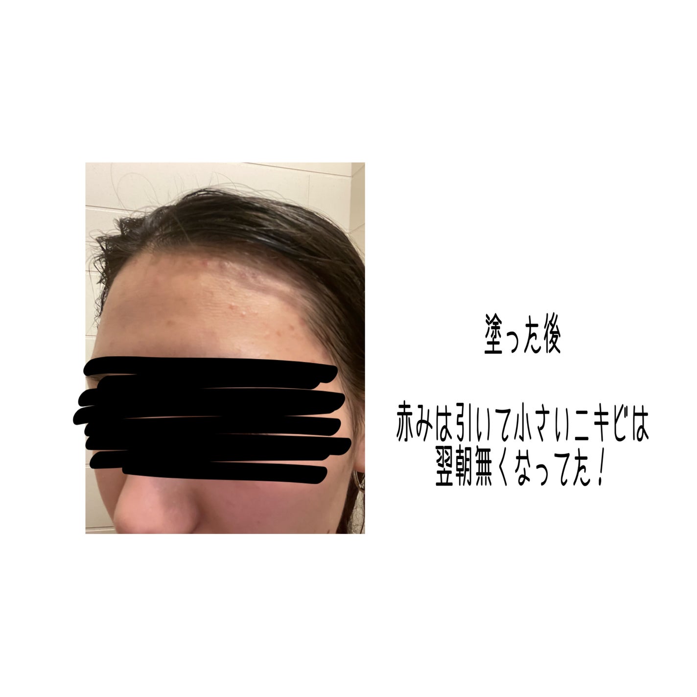 CICA カプセルマスク/VT/洗い流すパック・マスクを使ったクチコミ(4枚目)