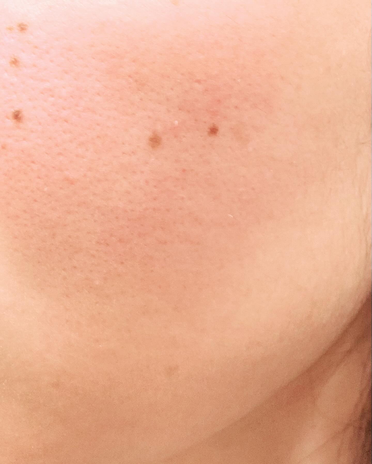 お米のパック/毛穴撫子/洗い流すパック・マスクを使ったクチコミ（3枚目）