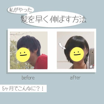 DHC 亜鉛/DHC/健康サプリメントを使ったクチコミ(1枚目)