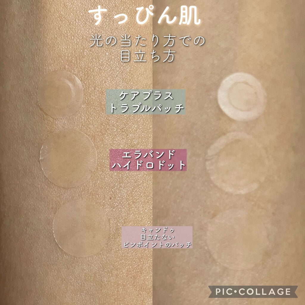 エラバンドパッチ/ElaBAND/その他を使ったクチコミ(4枚目)