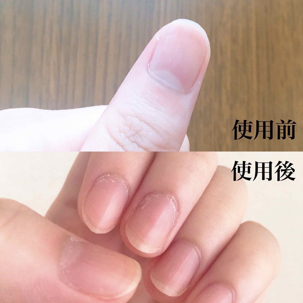 yuna** on LIPS 「ネイルケアにはこのセット一つで完了✨甘皮処理からジェル削りまで..」(4枚目)