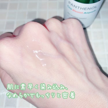 BIO HEAL BOH
パンテノール  シカ ブレミッシュ アンプル×２

塗るハイフだけじゃない
肌荒れの救世主🍀

🍀バイオヒールボだけの技術
Bio-deepbarrier™
リラックス、バリア強化に有効的な成分が 肌の最適なところまで伝達できる

パンテノール
ツボクサエキスポ
5種のシカ

🍀 リラックスバリア
パンテノール10%、シカ50%高含量
刺激を受けた肌をリラックスさせ、爽やかでなめらかな使用感でデイ/ナイトいつでも快適に使用

🍀 無香処方で肌により安全に！



こんな方に
01.デリゲートな肌ですぐに敏感になる肌
02.マスクと外部環境で刺激を受けた肌
03.油分がないリラックス水分アンプルが必要な肌


肌に素早く染み込み、なめらかでもっちりと密着します。
吹き出物があっても染みたりしないし、安心して使えそうです😌


★マスクで刺激を受けた肌や敏感肌、
保湿と同時にケアが必要な肌におすすめです。


もうすぐメガ割ですね❕狙うのも🙆‍♀️





提供元moreme

#PR #MOREME
#バイオヒールボ #韓国コスメ
＃タンタンクリーム #オリーブヤングPB
 #オリーブヤング #オリヤン  #パンテノールシカ
＃プロバイオダーム #弾力 #リフティングの画像 その2